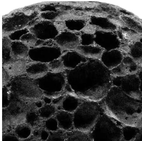 callus ball